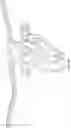 Fig. 40 - Suprapectineal quadrilateral bone plating system and methods of making and using same