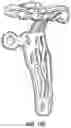 Fig. 56 - Suprapectineal quadrilateral bone plating system and methods of making and using same