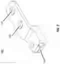 Fig. 03 - Systems and methods for treating rib fractures and osteotomies using implantation