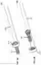 Fig. 06 - Systems and methods for treating rib fractures and osteotomies using implantation
