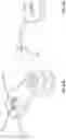 Fig. 12 - Systems and methods for treating rib fractures and osteotomies using implantation