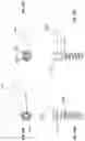 Fig. 21 - Systems and methods for treating rib fractures and osteotomies using implantation