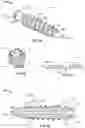 Fig. 02 - Orthopedic screw and porous structures thereof