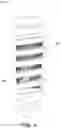 Fig. 05 - BONE SCREW