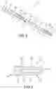 Fig. 04 - BONE STABILIZATION DEVICE