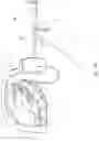 Fig. 101 - DETACHABLE SURGICAL TOOL CONFIGURED AS A FINITE STATE MACHINE