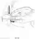 Fig. 118 - DETACHABLE SURGICAL TOOL CONFIGURED AS A FINITE STATE MACHINE