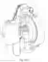 Fig. 168 - DETACHABLE SURGICAL TOOL CONFIGURED AS A FINITE STATE MACHINE