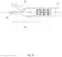 Fig. 52 - DETACHABLE SURGICAL TOOL CONFIGURED AS A FINITE STATE MACHINE