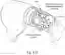 Fig. 92 - DETACHABLE SURGICAL TOOL CONFIGURED AS A FINITE STATE MACHINE