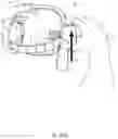 Fig. 94 - DETACHABLE SURGICAL TOOL CONFIGURED AS A FINITE STATE MACHINE