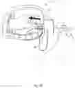 Fig. 99 - DETACHABLE SURGICAL TOOL CONFIGURED AS A FINITE STATE MACHINE