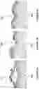 Fig. 04 - Methods and devices for thermal tissue vaporization and compression