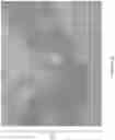 Fig. 06 - Methods and devices for thermal tissue vaporization and compression
