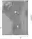 Fig. 07 - Methods and devices for thermal tissue vaporization and compression