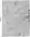 Fig. 15 - Methods and devices for thermal tissue vaporization and compression