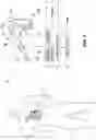 Fig. 02 - RADIO-FREQUENCY ABLATION AND DIRECT CURRENT ELECTROPORATION CATHETERS