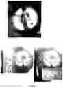 Fig. 16 - MICROWAVE APPARATUS AND METHOD