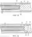 Fig. 11 - LASER ABLATION CATHETERS HAVING EXPANDED DISTAL TIP WINDOWS FOR EFFICIENT TISSUE ABLATION