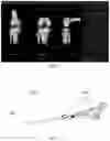 Fig. 06 - TOTAL KNEE ARTHROPLASTY ROBOT AUXILIARY SYSTEM, CONTROL METHOD AND ELECTRONIC DEVICE