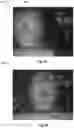 Fig. 05 - Method and system of determining operation pathway based on image matching