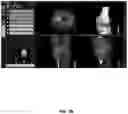 Fig. 100 - System and method for providing surgical planning and guidance with three-dimensional visualization