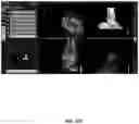 Fig. 102 - System and method for providing surgical planning and guidance with three-dimensional visualization