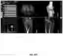 Fig. 103 - System and method for providing surgical planning and guidance with three-dimensional visualization