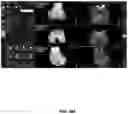 Fig. 105 - System and method for providing surgical planning and guidance with three-dimensional visualization