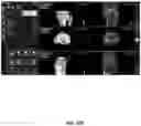 Fig. 106 - System and method for providing surgical planning and guidance with three-dimensional visualization