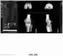 Fig. 109 - System and method for providing surgical planning and guidance with three-dimensional visualization