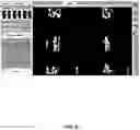 Fig. 58 - System and method for providing surgical planning and guidance with three-dimensional visualization