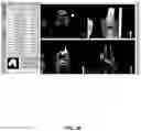 Fig. 59 - System and method for providing surgical planning and guidance with three-dimensional visualization