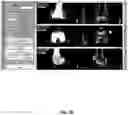 Fig. 60 - System and method for providing surgical planning and guidance with three-dimensional visualization
