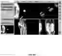 Fig. 65 - System and method for providing surgical planning and guidance with three-dimensional visualization