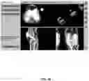Fig. 66 - System and method for providing surgical planning and guidance with three-dimensional visualization