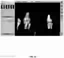 Fig. 68 - System and method for providing surgical planning and guidance with three-dimensional visualization