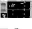 Fig. 69 - System and method for providing surgical planning and guidance with three-dimensional visualization