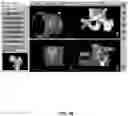 Fig. 70 - System and method for providing surgical planning and guidance with three-dimensional visualization