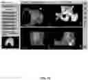 Fig. 71 - System and method for providing surgical planning and guidance with three-dimensional visualization