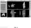 Fig. 72 - System and method for providing surgical planning and guidance with three-dimensional visualization