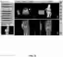 Fig. 73 - System and method for providing surgical planning and guidance with three-dimensional visualization