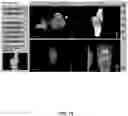 Fig. 74 - System and method for providing surgical planning and guidance with three-dimensional visualization