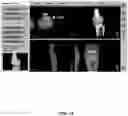 Fig. 75 - System and method for providing surgical planning and guidance with three-dimensional visualization