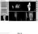 Fig. 76 - System and method for providing surgical planning and guidance with three-dimensional visualization