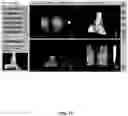 Fig. 78 - System and method for providing surgical planning and guidance with three-dimensional visualization