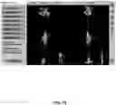 Fig. 80 - System and method for providing surgical planning and guidance with three-dimensional visualization