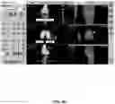 Fig. 81 - System and method for providing surgical planning and guidance with three-dimensional visualization