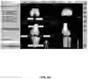 Fig. 83 - System and method for providing surgical planning and guidance with three-dimensional visualization