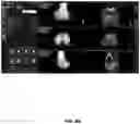 Fig. 86 - System and method for providing surgical planning and guidance with three-dimensional visualization